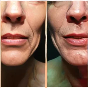 Почему даже небольшой ремонт требует четкой последовательности